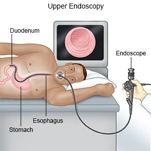 Gastroenterologist in Orlando FL procedure